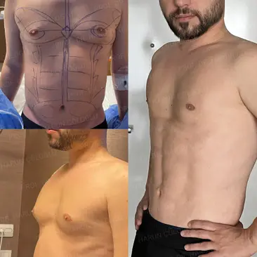 Öncesi ve Sonrası 7